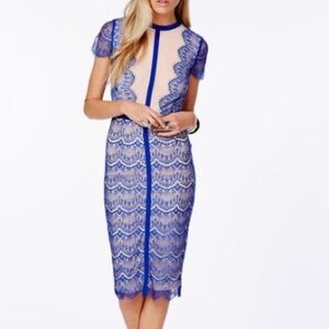 Elegant Blue Lace Dress